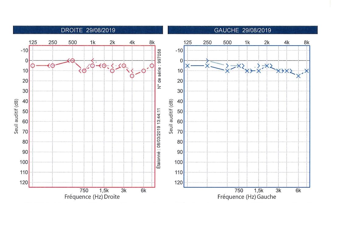 Quest Ce Quun Audiogramme Et Comment Le Lire Earpros Fr